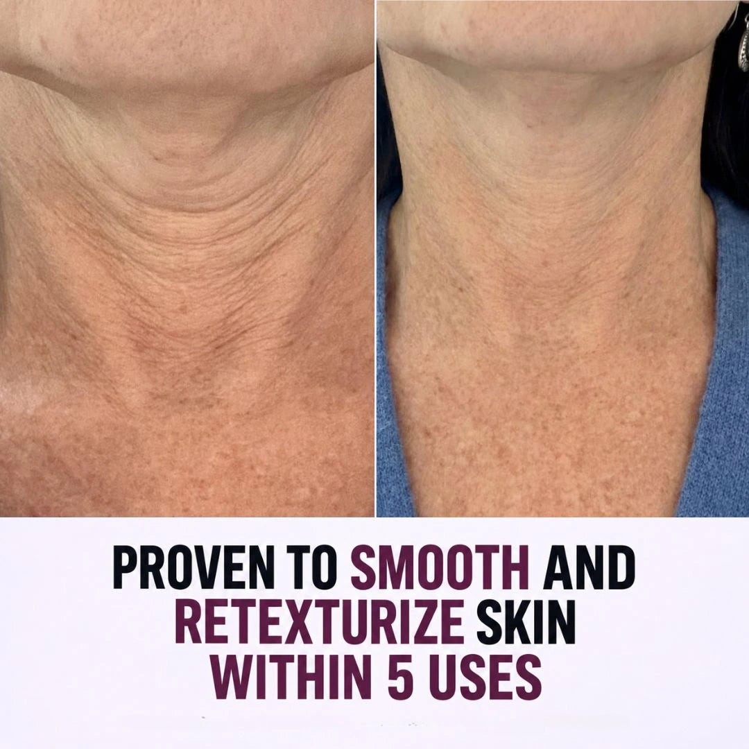 CIORA® Tighten & Lift Neck Cream