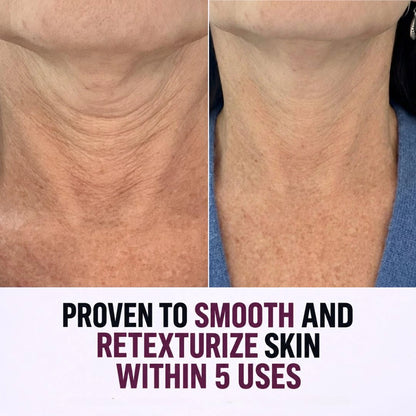 CIORA® Tighten & Lift Neck Cream